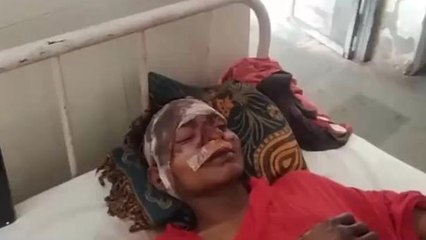 सीधी: भीषण सड़क हादसे में 3 लोग हुए गंभीर घायल, वीडियो देख कांप गई रूह