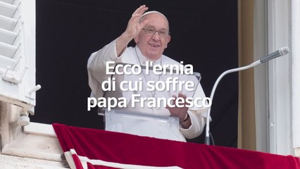 Ecco l'ernia di cui soffre papa Francesco
