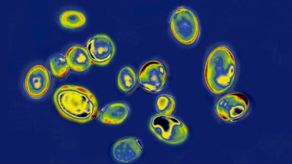 What you need to know about the deadly fungal infection Candida auris