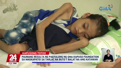 Скачать видео: Paunang resulta ng pagtulong ng GMA Kapuso Foundation sa magkapatid sa Tarlac na buto't balat na ang katawan | 24 Oras