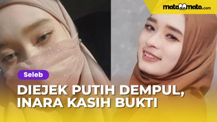 Diejek Putih gegara Dempul, Inara Rusli Kasih Pembuktian di Tempat: Pernah Bilang Perawatan Ratusan Juta