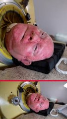 Cette homme vit avec un poumon d'acier depuis 70 ans