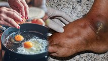 अंडा पकाने का सही तरीका क्या है । Anda Pakane Ka Sahi Tarika Kya Hai । Boldsky