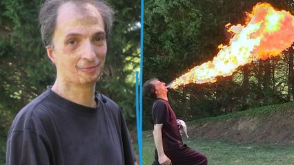 Grand brûlé devenu cracheur de feu, l’incroyable histoire de Grégory Montagna