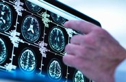 Brain-scanning tech risks workplace surveillance