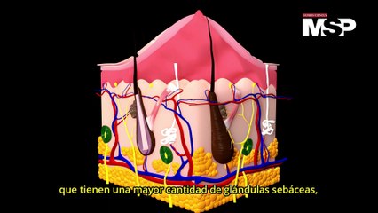 ¿Cómo funciona la dermatitis seborreica? - #ExclusivoMSP