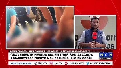 ¡Gravemente herida! "Machetero" ataca a mujer frente a su pequeño hijo en Copán