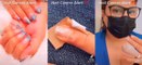 VÍDEO: Mulher desenvolve cancer de pele após ida a manicure