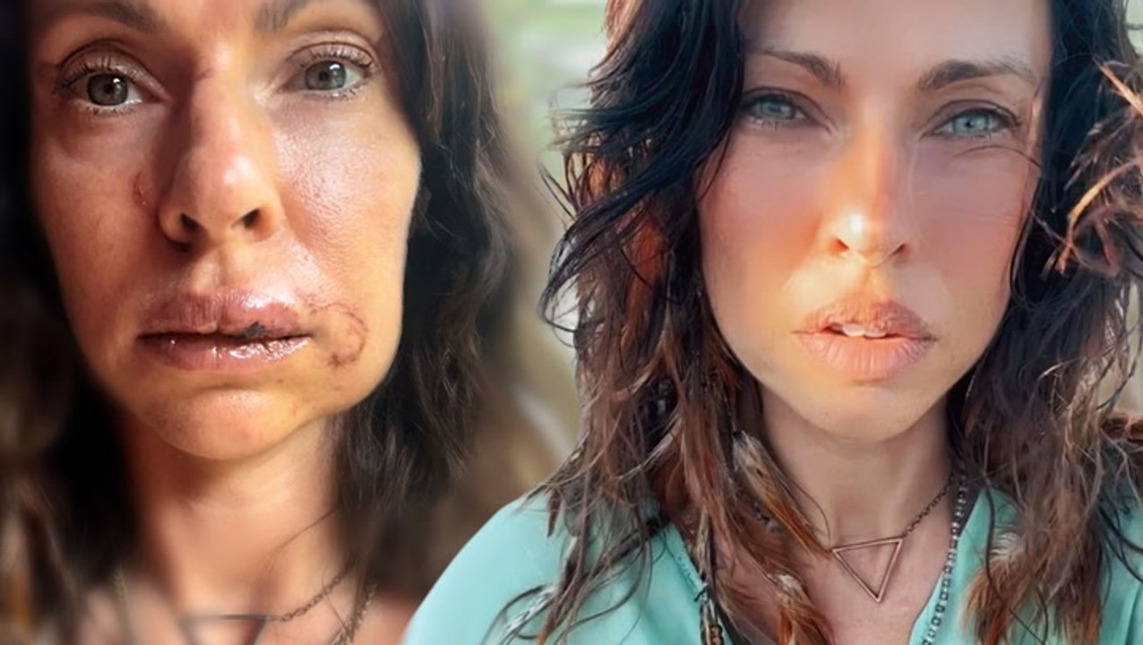 Jana Urkraft Pallaske überlebt Überfall: „Versuchte, mich zu vergewaltigen“