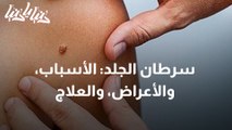 سرطان الجلد الأسباب، والأعراض، والعلاج