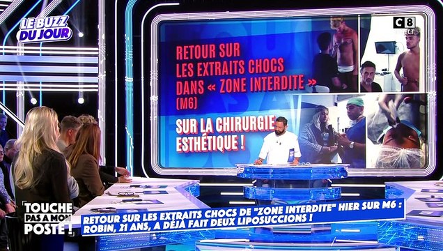 Robin était invité dans TPMP ce lundi 16 janvier pour pousser un coup de gueule suite à son passage dans le dernier numéro de Zone Interdite consacré aux dérives scandaleuses de la chirurgie esthétique