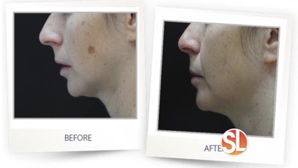 Turn Back Time can help your skin look spot free!