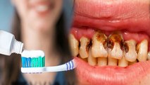 लंबे समय तक Tooth Brush नहीं करने से होंगे ये गंभीर नुकसान | Toothbrush Na Karne Ke Nuksan | Boldsky