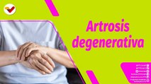 Buena Vibra | ¿Qué es la artrosis degenerativa?