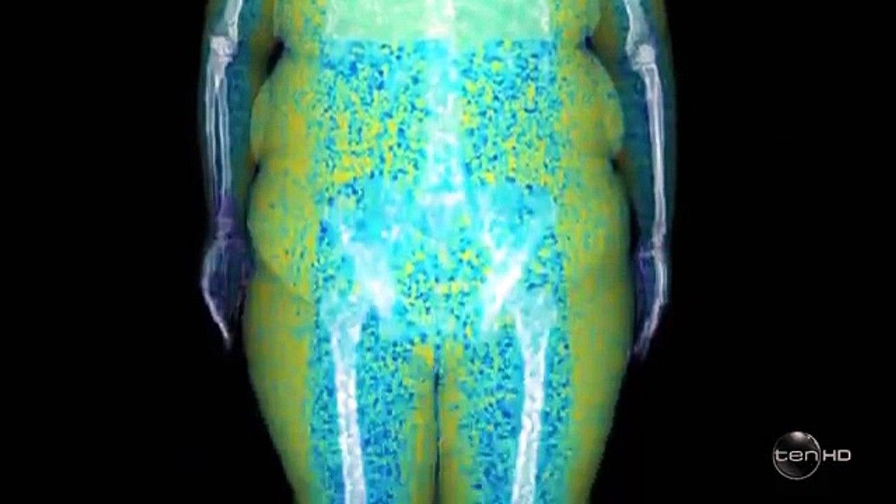 The Biggest Loser AU - Se11 - Ep05 HD Watch