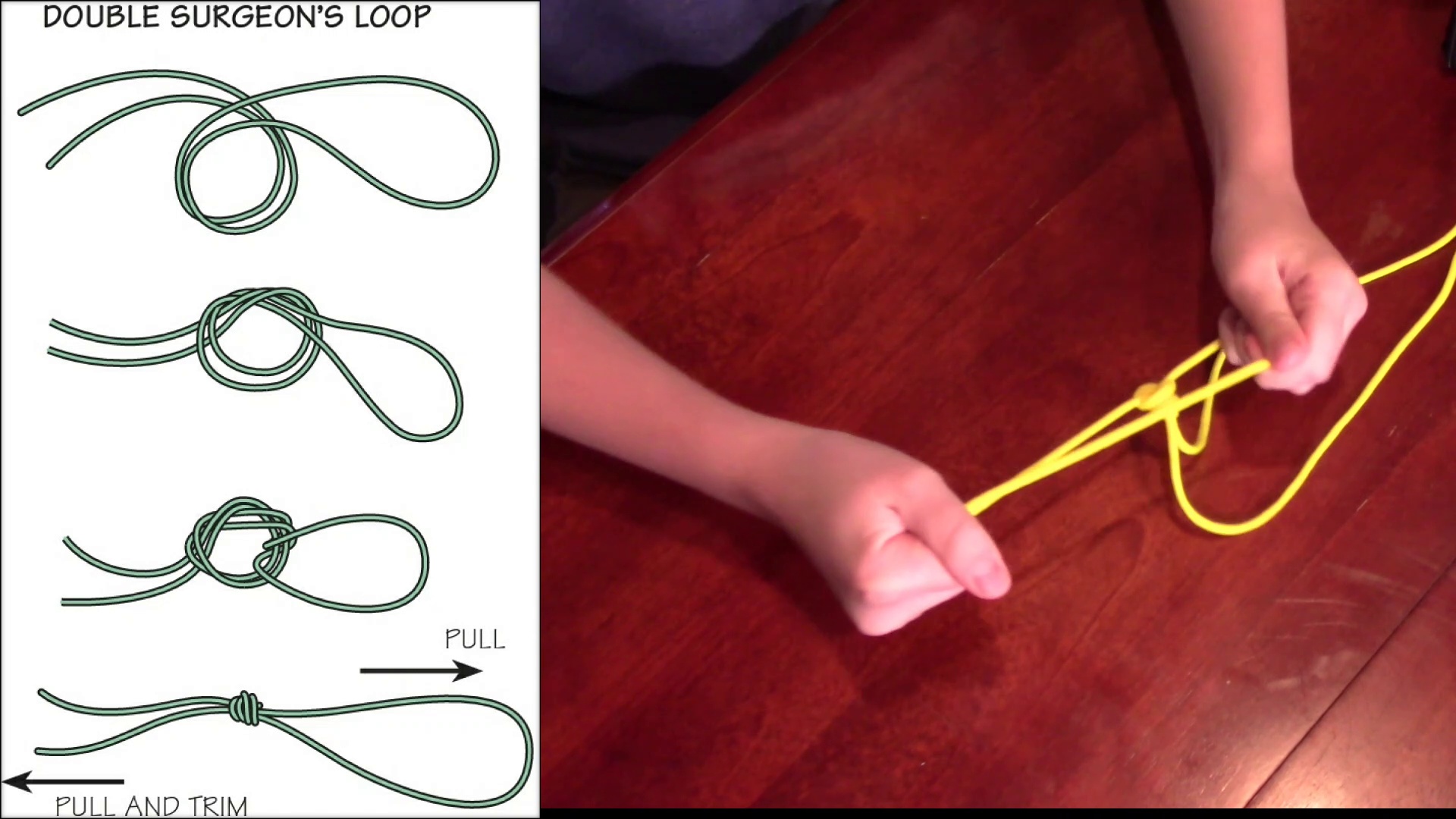 Double Surgeons Loop Fly Fishing Merit Badge