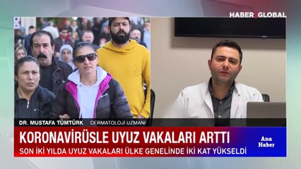 Biri bitmeden diğeri başlıyor! Şimdi de uyuz alarmı! Vakalar iki kat arttı