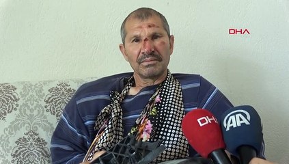 Kendisine çarpan aracın parçalarını sakladı! "İnsan olan geçmiş olsun der"