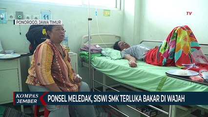 Ponsel Meledak, Wajah Siswi SMK Terluka Bakar