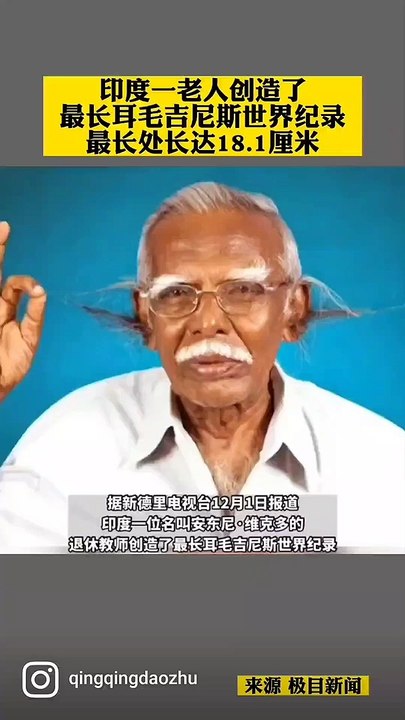 印度  老人耳毛创#吉尼斯 纪录。最长18厘米！An Indian man has set a #Guinness World Record for ear hair. 18 cm long!