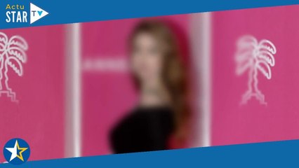 Ici tout commence : Une actrice "brûlée au 3e degré", elle dévoile une photo inquiétante