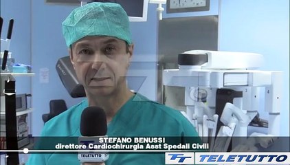 Video News - CHIRURGIA CORONARICA CON UN ROBOT