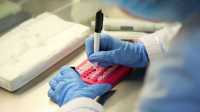 Nuova luce sulla distrofia di Duchenne