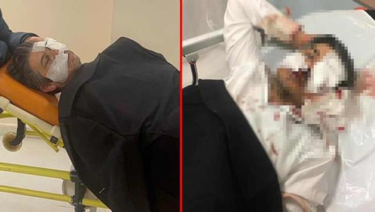 Sivas Ziraat Odası genel sekreteri saldırıda ağır yaralandı