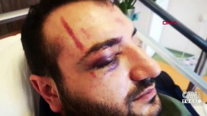 Doktorların kavgasında darbedilen anestezi asistanı: Beni kanlar içinde bırakıp gittiler