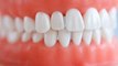 Teeth Whitening  AT HOME TEETH WHITENING KIT - Snow Teeth Whitening Kit 01182023