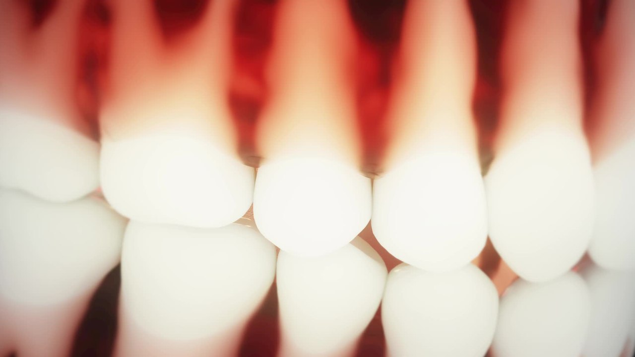Worried about your wisdom teeth, this is when you should consider having them removed