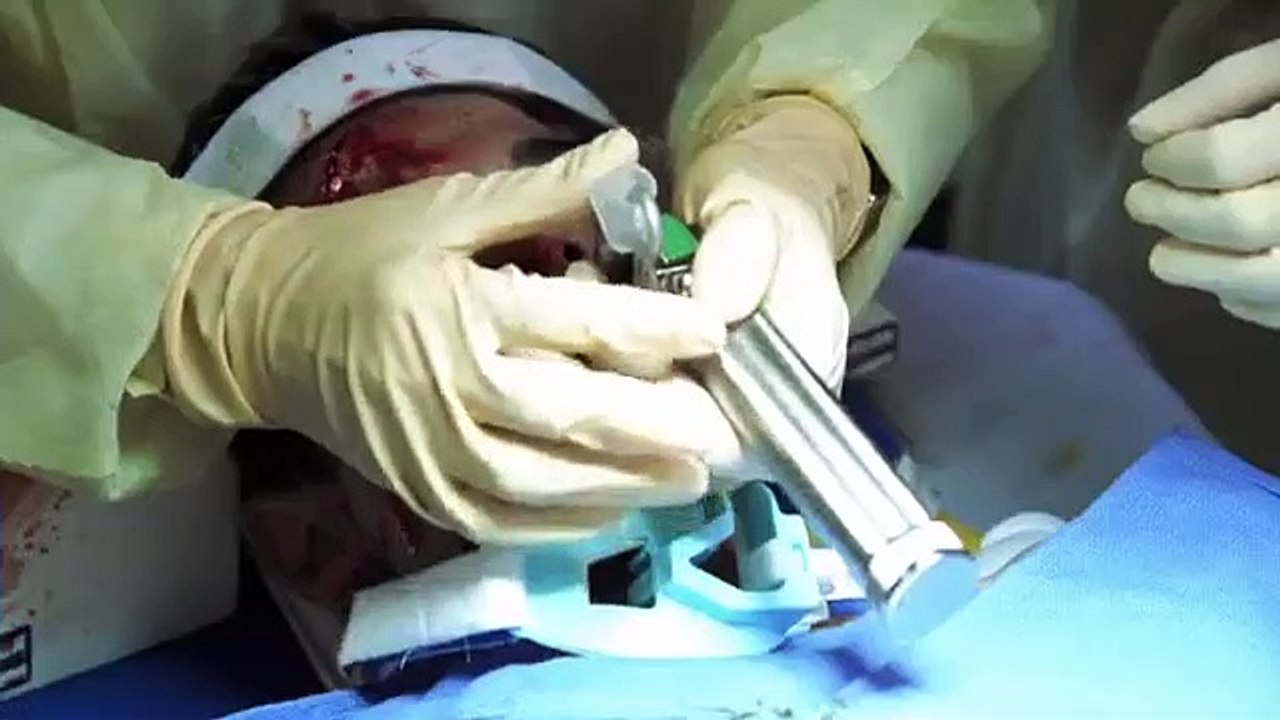 ER - Se8 - Ep07 - If I Should Fall from Grace HD Watch