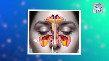 சைனஸ் பிரச்சினையை தவிர்ப்பது எப்படி_ - ஓர் எளிய வழிகாட்டி