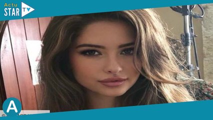 Pola Petrenko (Ici tout commence) « brûlée au troisième degré », elle partage une photo choc