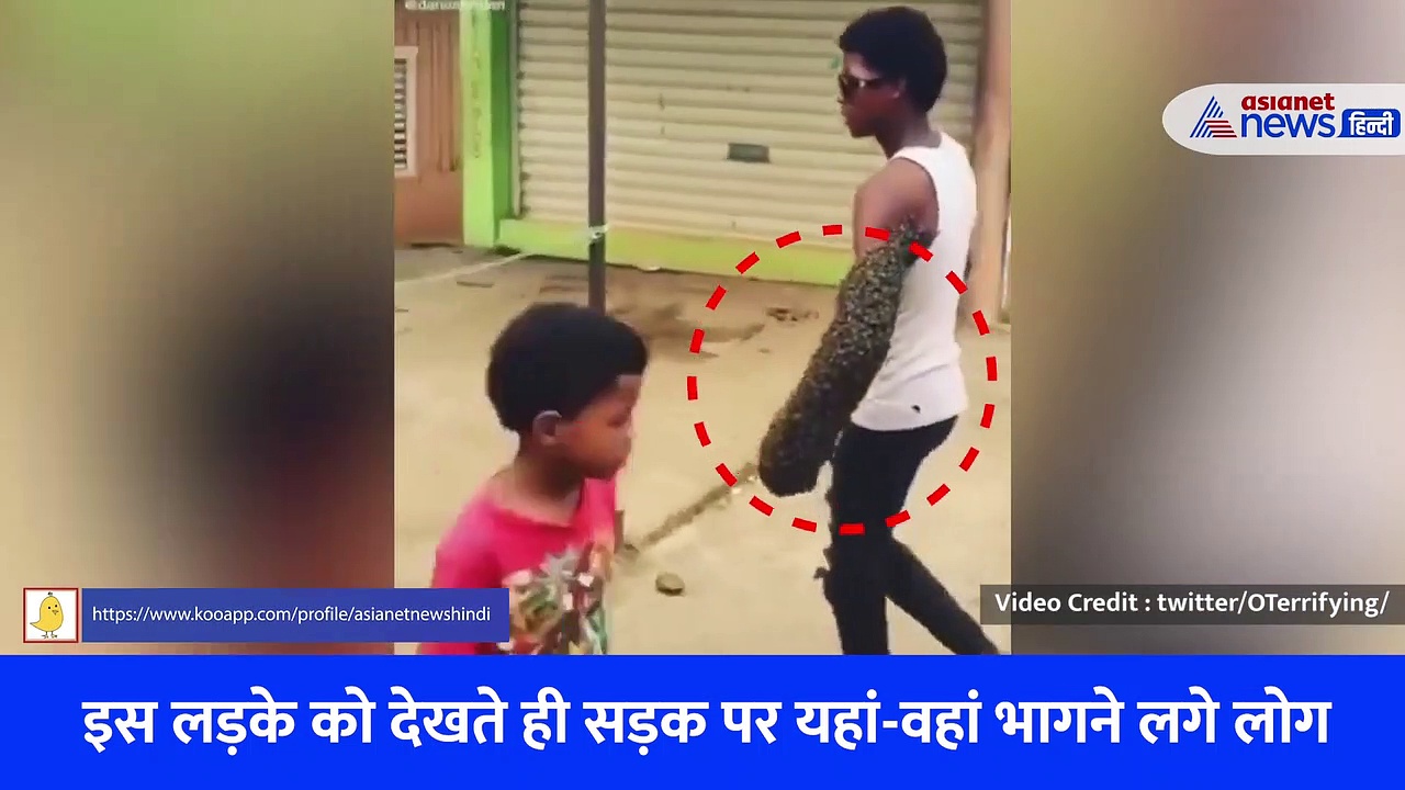 इस लड़के को सड़क पर देखते ही यहां-वहां भागने लगे लोग, हाथ देखकर हर कोई कांप गया