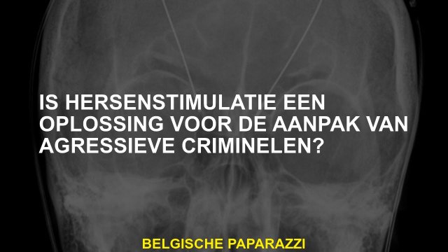 Is hersenstimulatie een oplossing voor het aanpakken van agressieve criminelen?