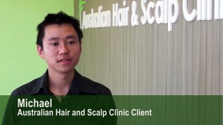 Michael Case Study - Australian Hair and Scalp Clinic