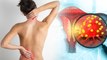 पीठ पर ऐसे निशान दिखना Cervix Cancer Symptoms, तुरंत कराएं जांच |Boldsky*Health
