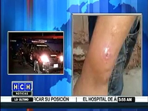 Tirotean a dos supuestos sicarios motorizados y otros sucesos en la capital