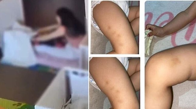 2 yaşındaki çocuğa kreşte darp: 2 görevli suçlamayı kabul etmedi