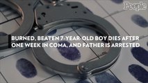 Burned, Beaten 7-Year-Old Boy Dies After One Week in Coma, and Father is Arrested