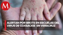 En Veracruz, primaria suspende clases por contagios de virus coxsackie