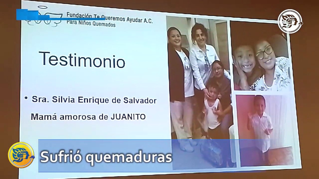 Tras sufrir quemaduras, Juanito recupera sus dedos; hoy tiene un futuro esperanzador