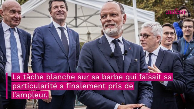 Edouard Philippe métamorphosé : cette nouvelle apparence due à ses deux maladies auto-immunes