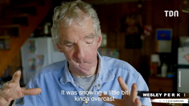 Dents, langue et mâchoire arrachés : un homme sauvagement attaqué par un ours (Vidéo)