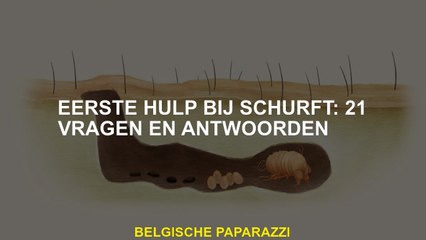 Eerste hulp voor schurft: 21 vragen en antwoorden