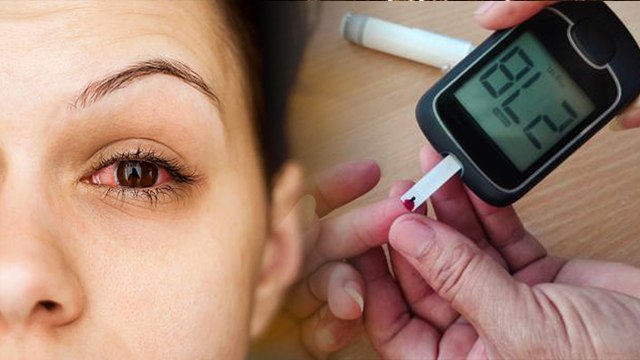 सुबह उठने पर धुंधला दिखना इस गंभीर बीमारी का लक्षण, सुबह उठने पर धुंधला दिखने का कारण | Boldsky