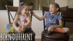 The Conjoined Twins Who Were Separated | BORN DIFFERENT