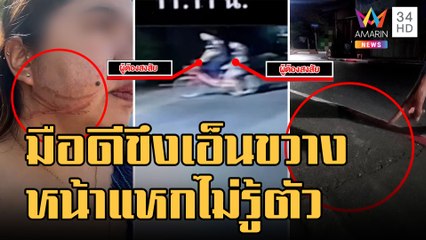 พยาบาลสาวร้อง! ขับรถอยู่ดีดีหน้าแหก ถูกมือดีขึงเอ็นขวางถนน | ข่าวเที่ยงอมรินทร์ | 31 ม.ค.66