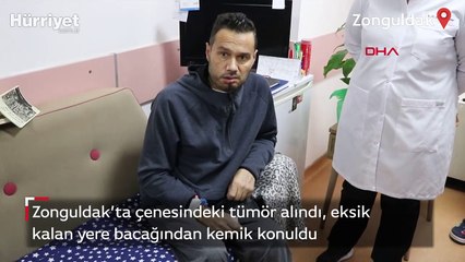 Çenesindeki tümör alındı, eksik kalan yere bacağından kemik konuldu